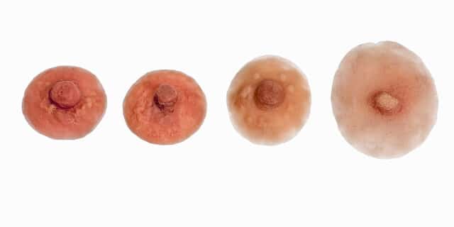 breast replacement forms